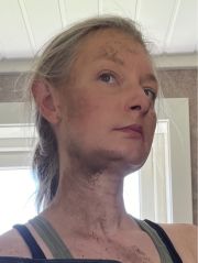 Bilder av VonVargas fra Østfold